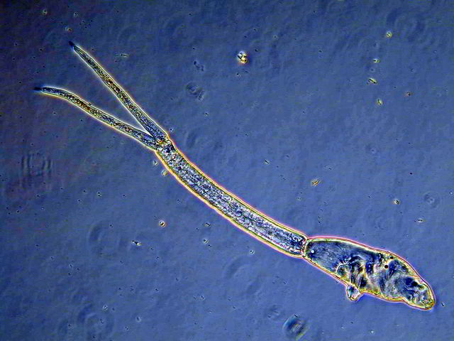 Nachgefragt | Badegäste geschockt: Parasitenwarnung am Roither See!